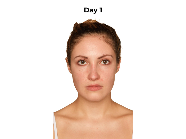 Kelsey day 1 photo (frontal)