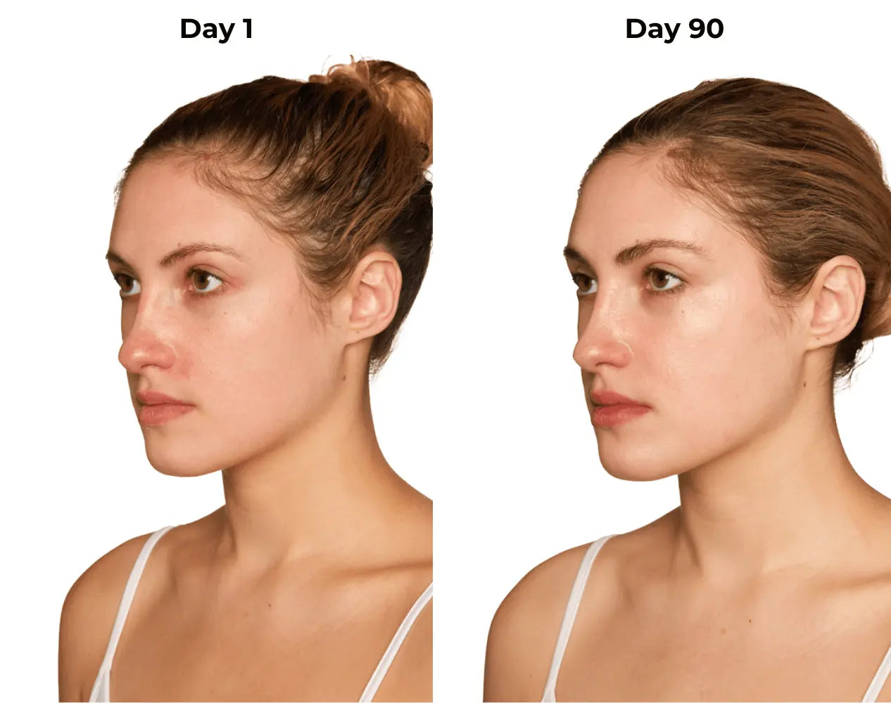 Kelsey day 1 and day 90 photos