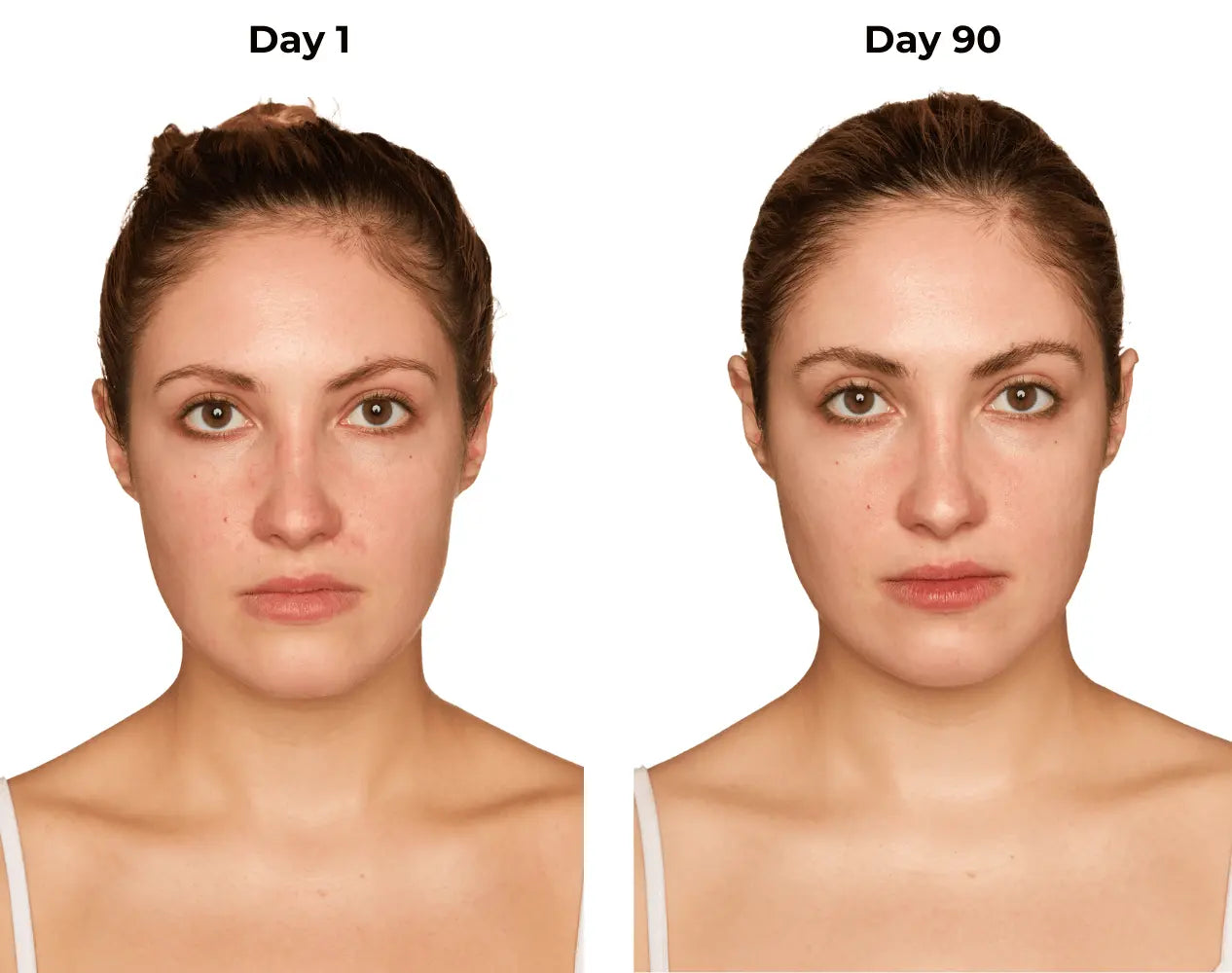 Kelsey day 1 and day 90 photos (frontal)