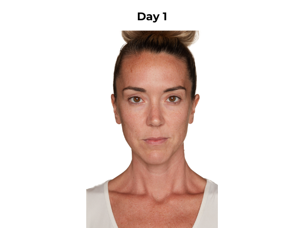 Lisa day 1 photo (frontal)