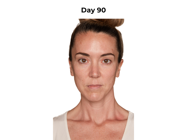 Lisa day 90 photo (frontal)