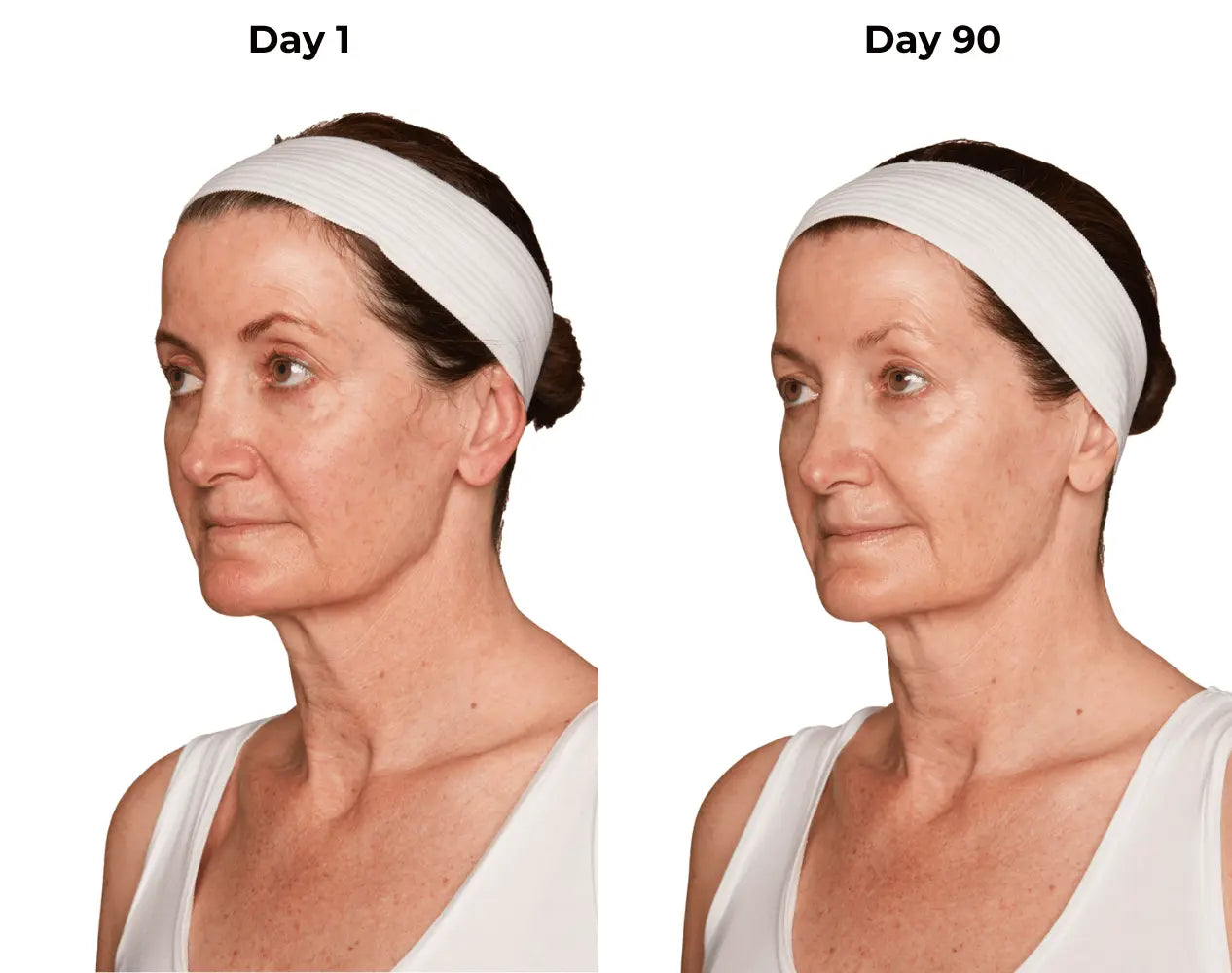 Mon day 1 and day 90 photos