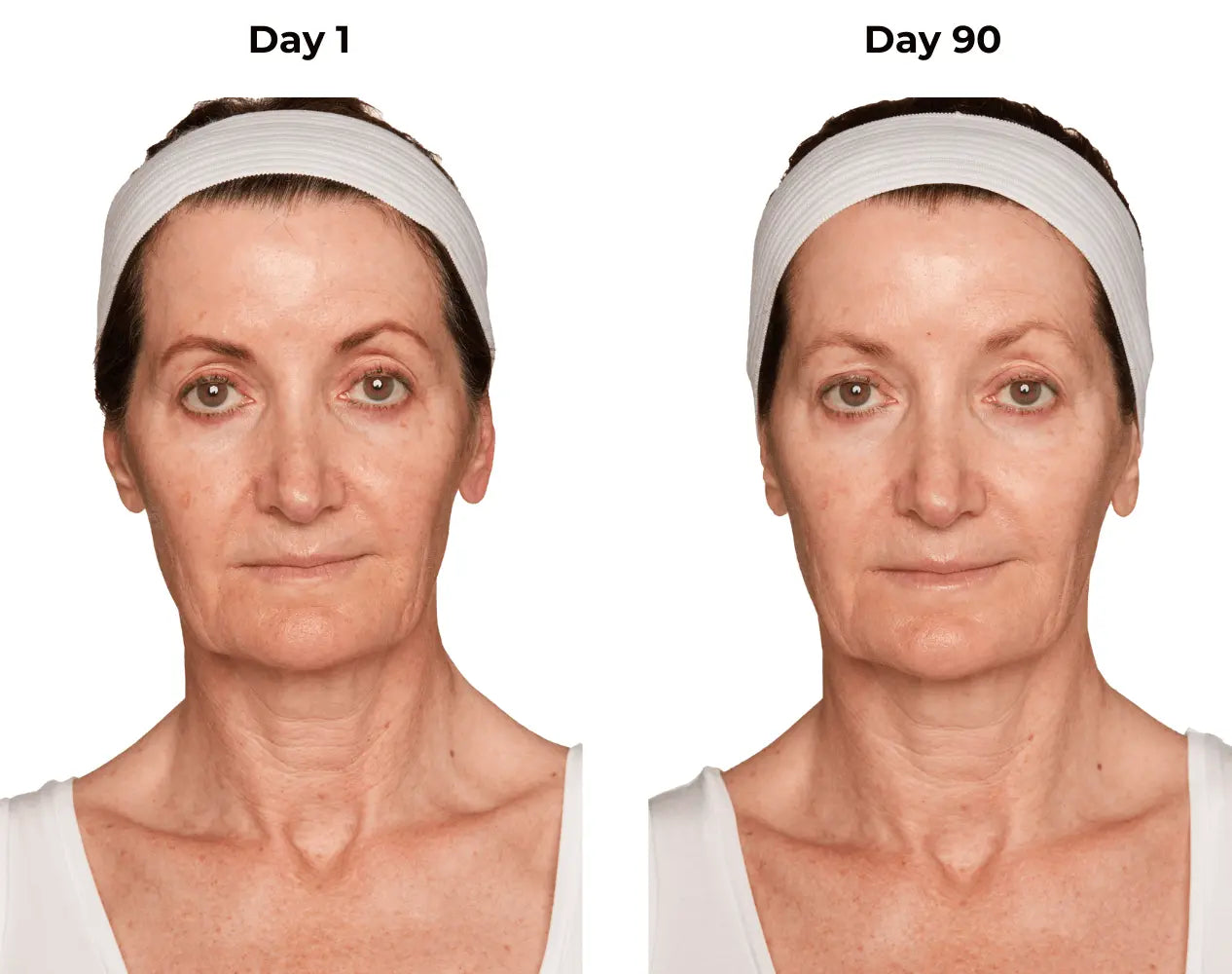 Mona day 1 and day 90 photos (frontal)