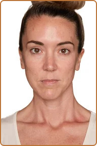 a woman user of True Alchemy's Eye Elixir
