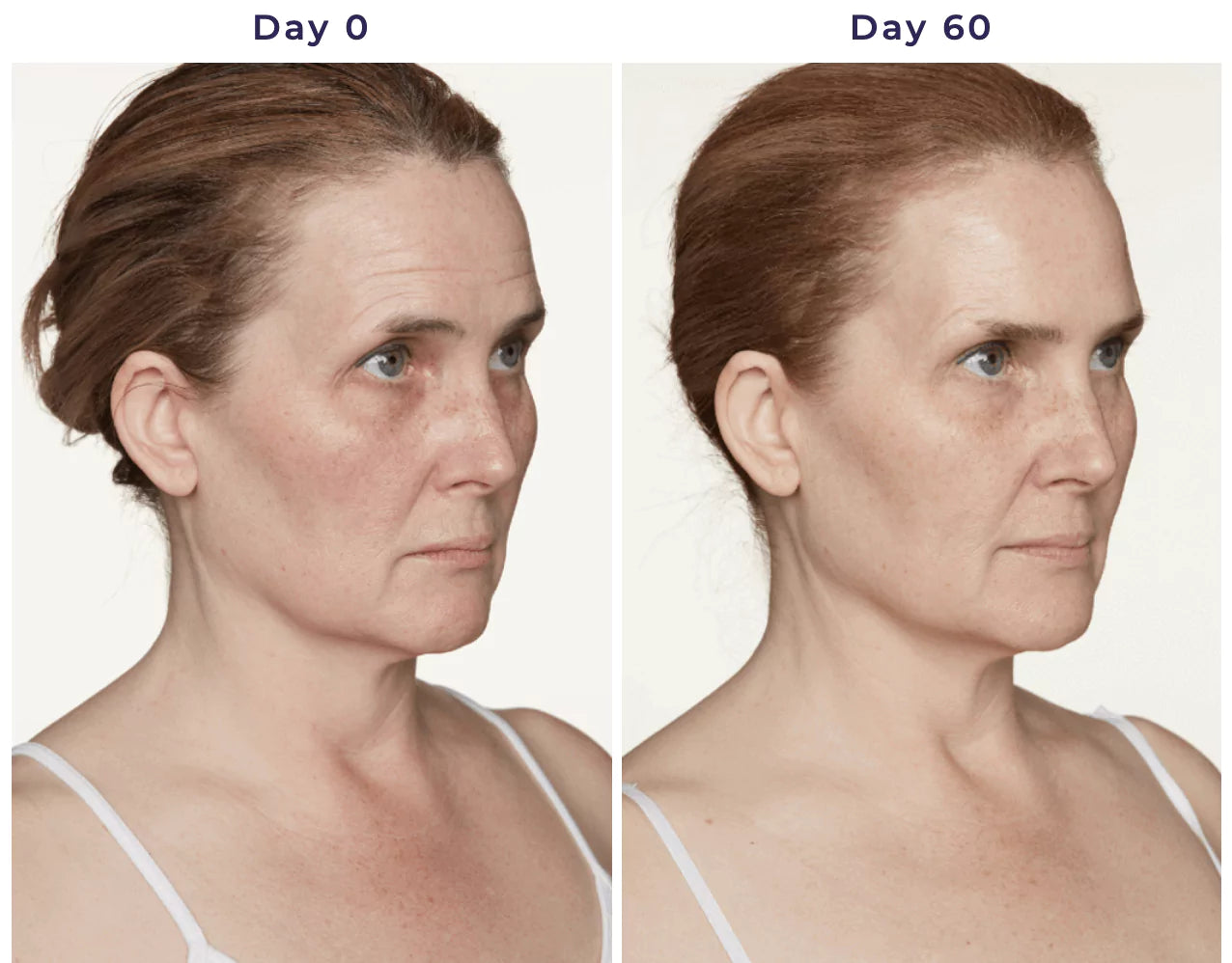 Kim's day 1 and day 60 quarter shots