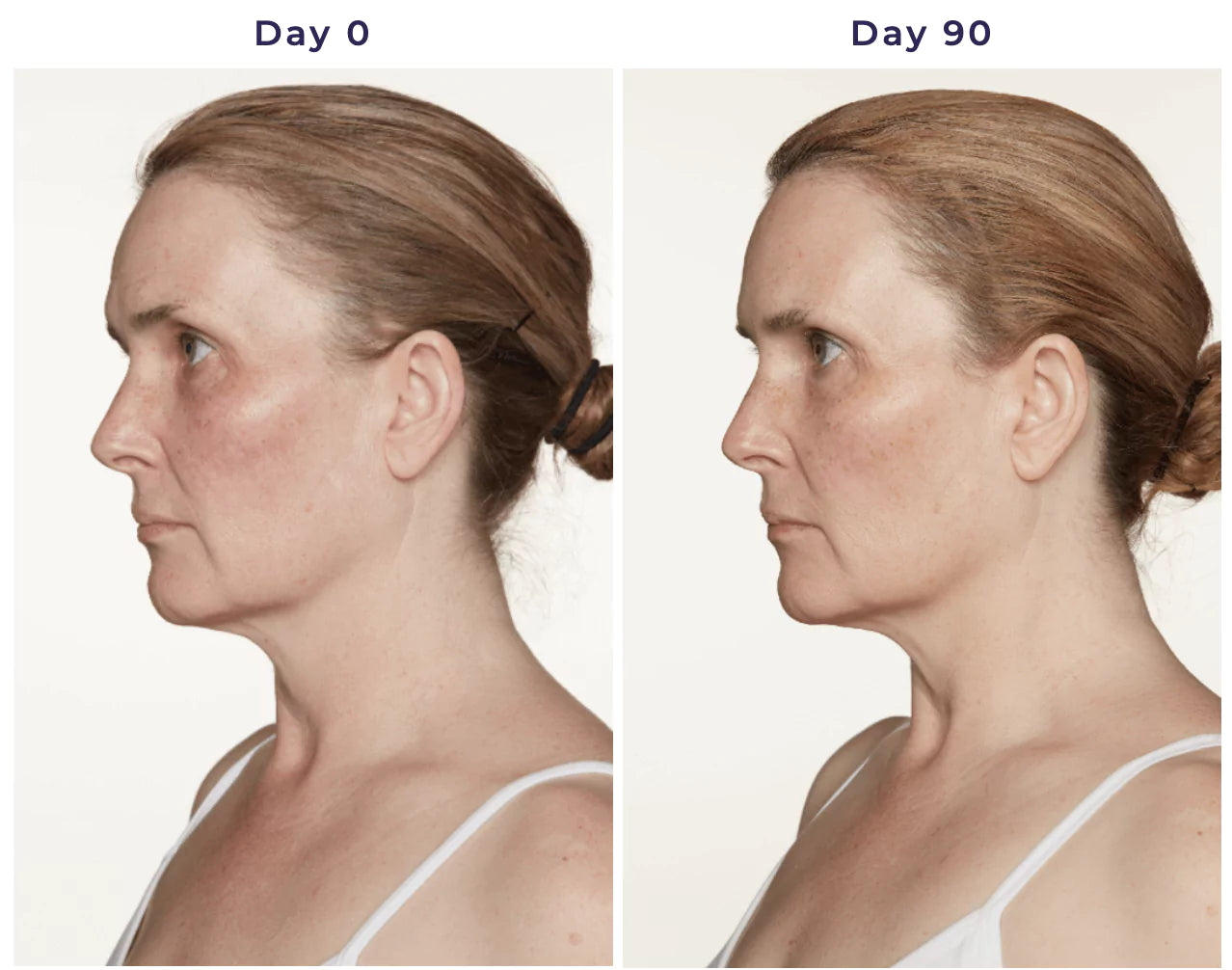 Kim's day 1 and day 90 side shots