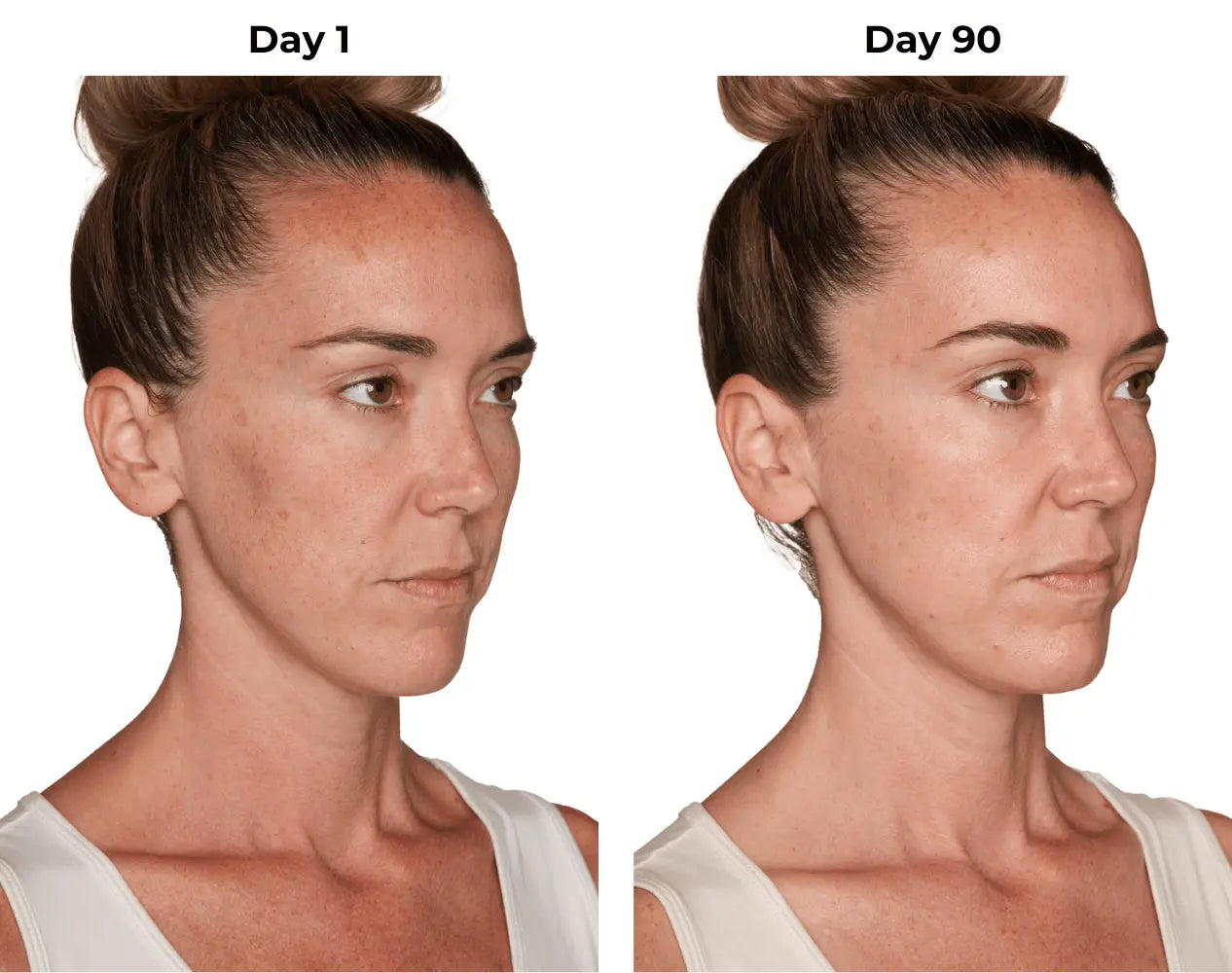 Lisa day 1 and day 90 photos