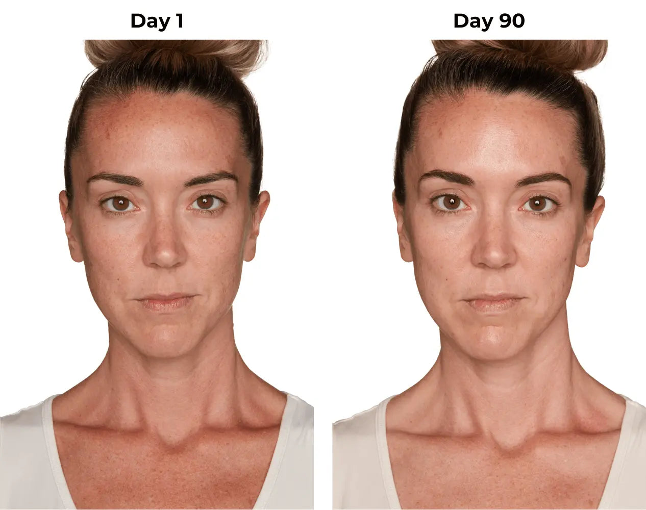 Lisa day 1 and day 90 photos (frontal)