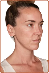 Lisa day 90 right profile picture